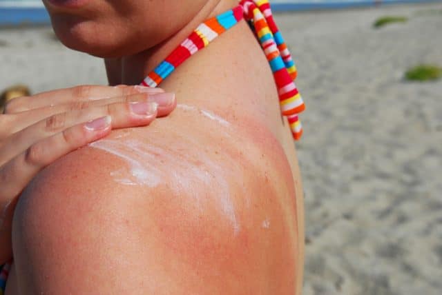 woman applying sunblock